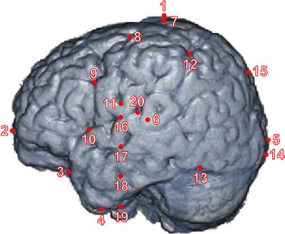 Macroanatomical Landmarks Featuring Junctions of Major Sulci and Fissures and Scalp Landmarks Based on the International 10–10 System for Analyzing Lateral Cortical Development of Infants